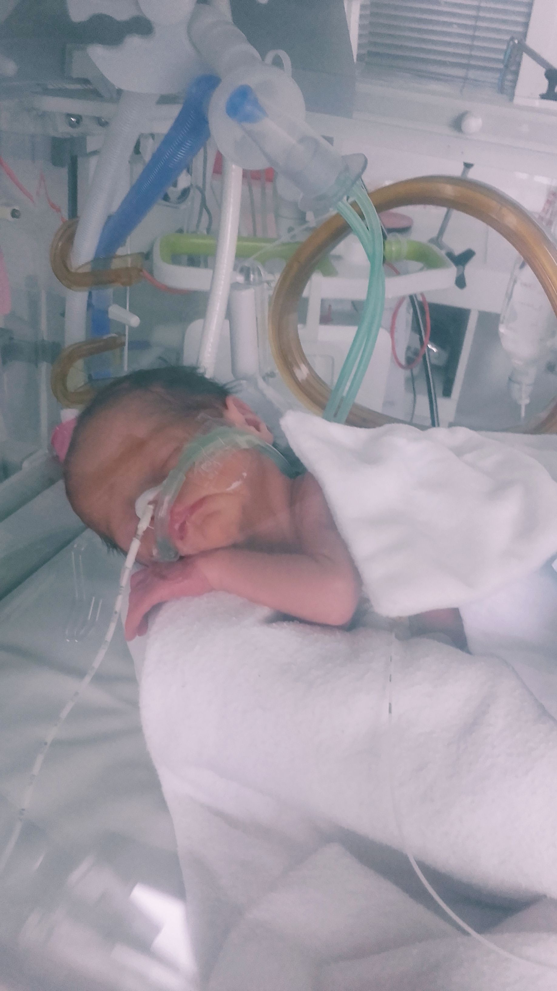 Comment se passe l'apres accouchement avec un bébé prématuré ?