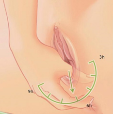 Les exercices de massage périnéal : le balancier