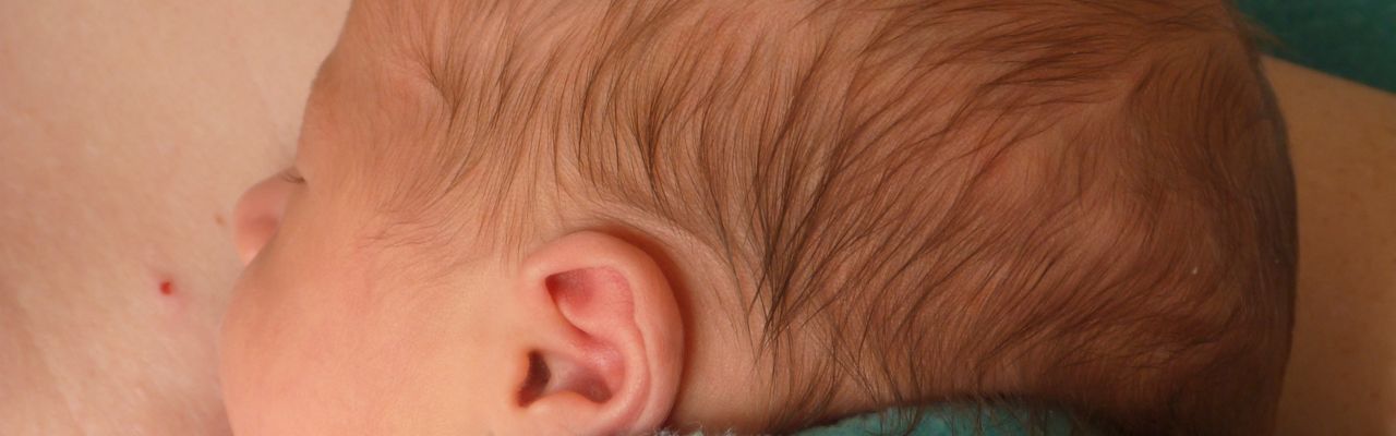 C&eacute;l. & L. : endom&eacute;triose et accouchement en si&egrave;ge par voies basses